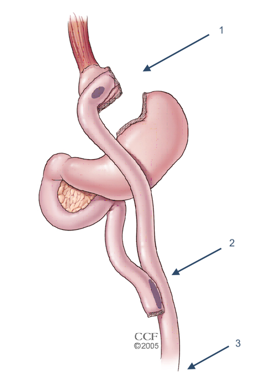 Vitamin Bariatric