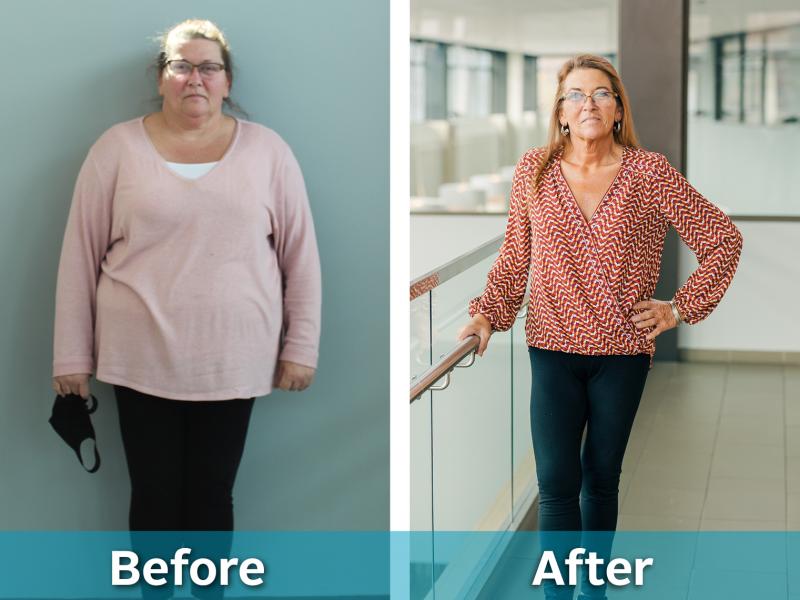 Bariatric Surgery Must Haves