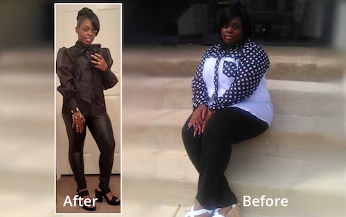 Vitamin For Bariatric