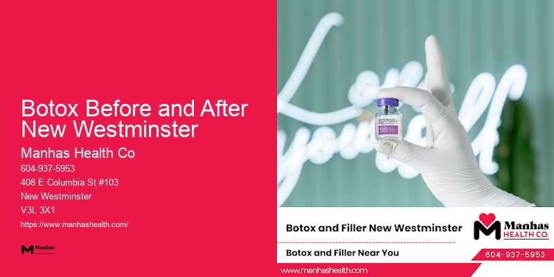 Neuromodulator Treatments Botox Before and After New Westminster