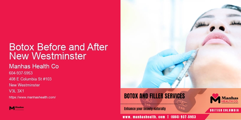 Innovative Facial Rejuvenation Technologies Botox Before and After New Westminster