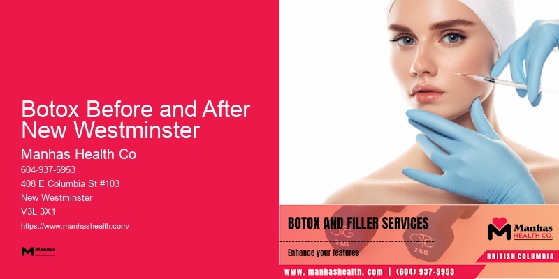 Unique Injectable Beauty Solutions Botox Before and After New Westminster