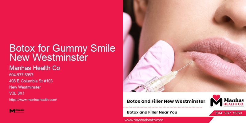 Dermal Fillers Botox for Gummy Smile New Westminster