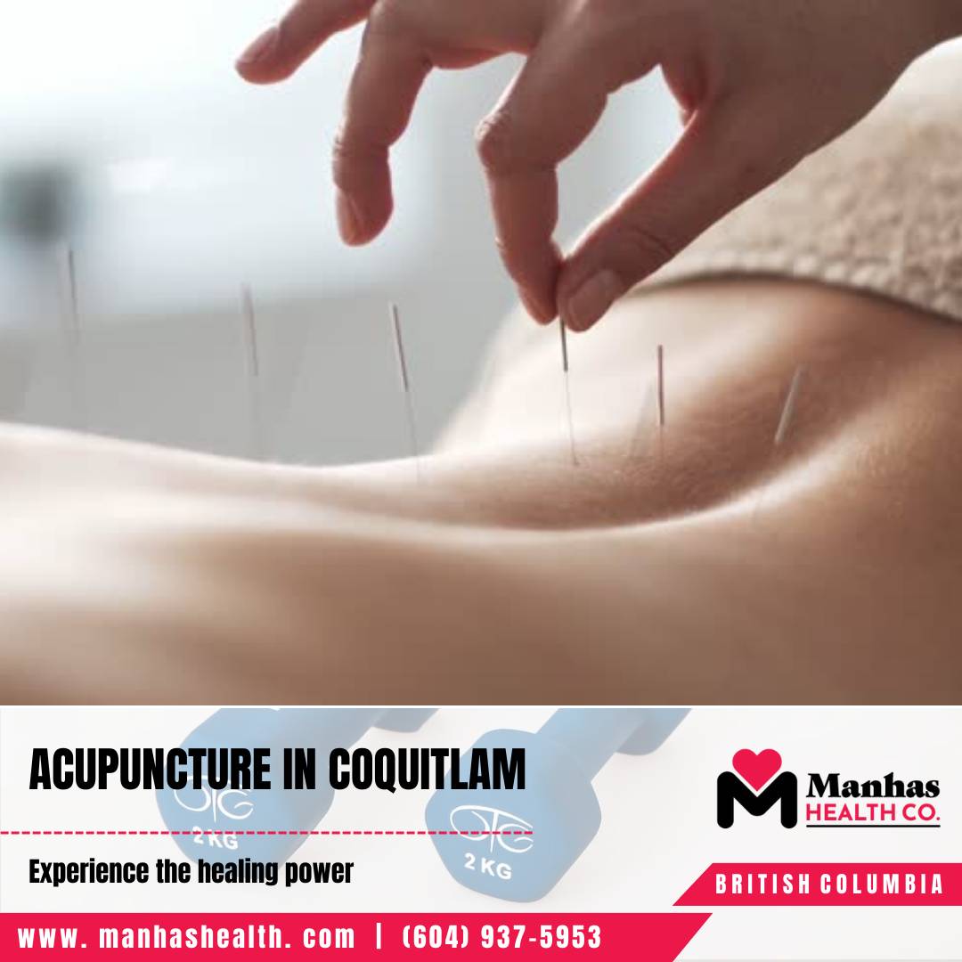 Top-Rated Physiotherapist for Joint Health Experienced Physiotherapist Coquitlam